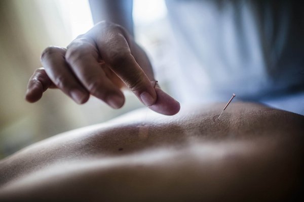 Comment l'acupuncture peut-elle aider dans le traitement des troubles de la fertilité ?