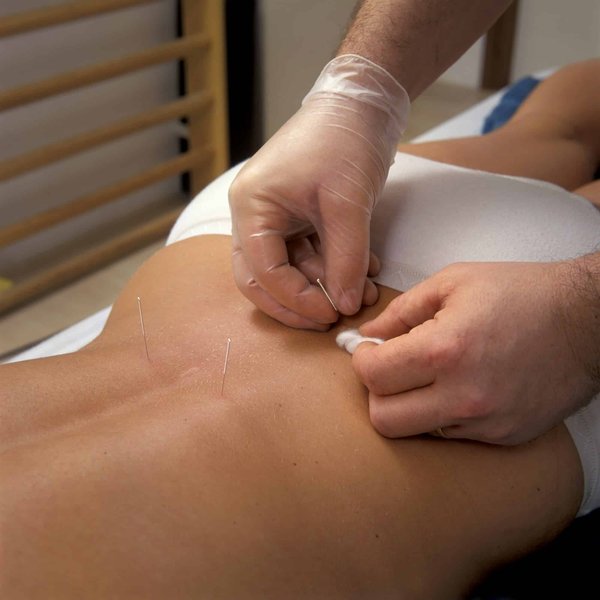 Annuaire acupuncteur à Nantes : pour quelle raison le consulter ?